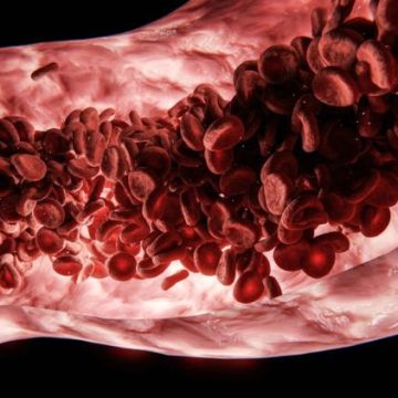 Les symptômes de problèmes de circulation sanguine à surveiller