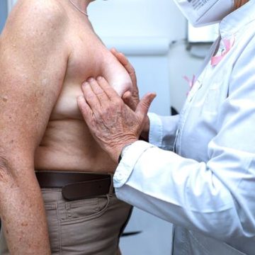 Les bienfaits de l’alimentation biologique dans la réduction du risque de cancer du sein