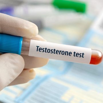 La testostérone et son rôle controversé dans la santé féminine