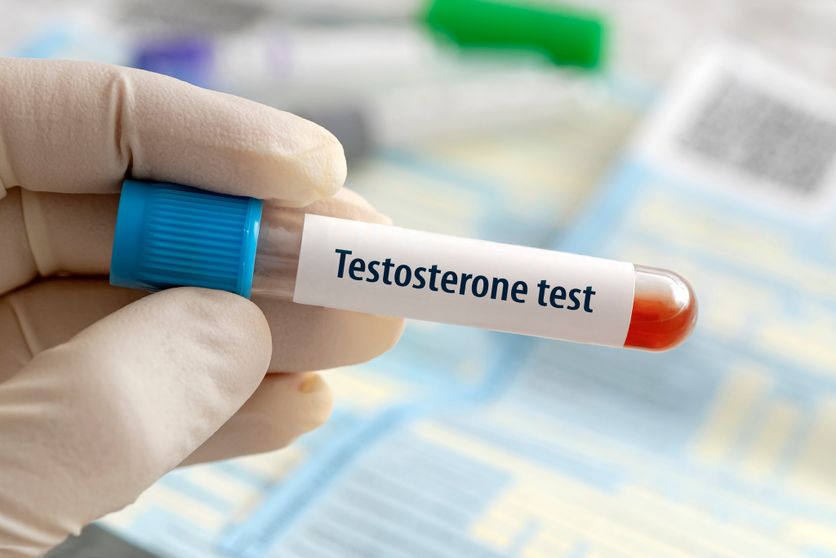 Testosterone hormone test result with blood sample in test tube on doctor hand in medical lab a blue laboratory background. La testostérone et son rôle controversé dans la santé féminine