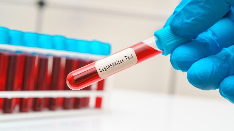 615173d8-86a2-4a89-9577-023c1f9181c5 Recrudescence de légionellose en Savoie : 41 cas recensés, deux décès