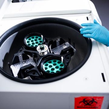 La biotech et Merck annoncent des avancées contre le mélanome