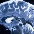 Une découverte sur le cerveau humain bouleverse la recherche médicale