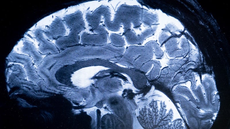03ad3bf8-726d-4b4a-a7cf-82953094bafa Une découverte sur le cerveau humain bouleverse la recherche médicale