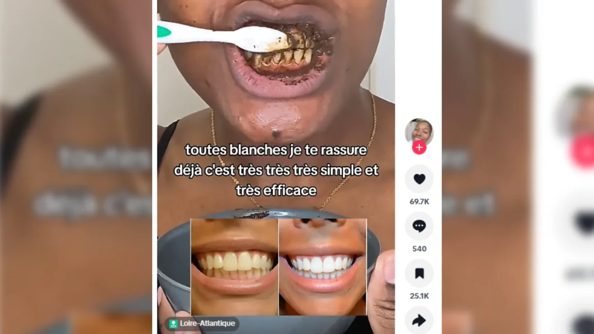 252a1a05-fd50-429d-8225-27f8e01d88c0 Les dangers des recettes maison pour blanchir les dents