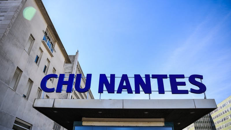 511e8d8c-54e0-4121-9ac2-dd6682de8e30 Suivi des bébés opérés du cœur au CHU de Nantes