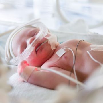 Le suivi des enfants nés prématurément en France