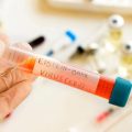 Les infections responsables d&rsquo;un nombre important de cas de cancer dans le monde