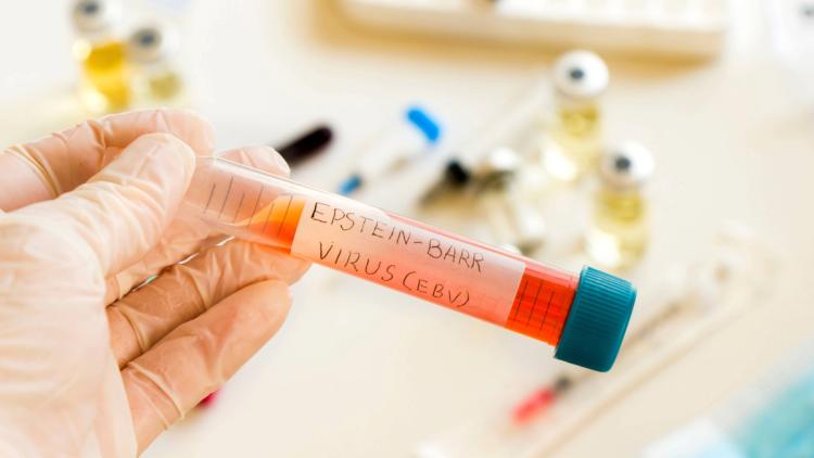 7c5098a3-507e-4d2c-ad58-7c68c76a8e6f Les infections responsables d’un nombre important de cas de cancer dans le monde