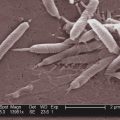 Les infections, une cause majeure du cancer