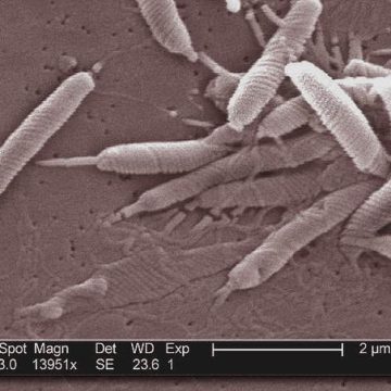 8869e377-750c-4422-aec8-e12ad019fa81 Les infections, une cause majeure du cancer