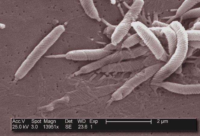 8869e377-750c-4422-aec8-e12ad019fa81 Les infections, une cause majeure du cancer