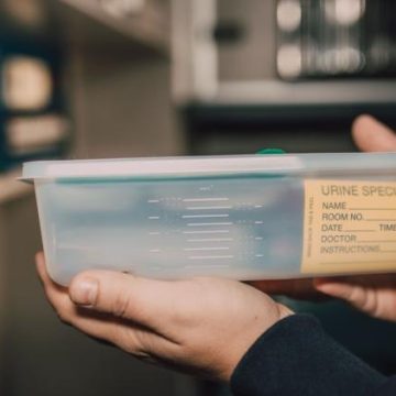 ba398fc7-94b3-4fa3-9a2a-a07ef73a2d93 Les tests urinaires à domicile, une avancée dans le diagnostic du cancer de la vessie