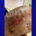 Violences Urbaines à Saint-Pierre-des-Corps