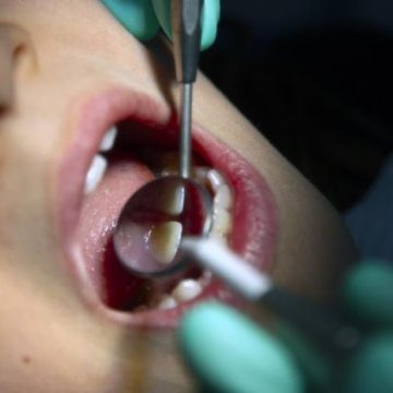 f61c62de-aa89-49af-a9b0-7422e65dbb84 Réduction du remboursement des soins dentaires par l’Assurance Maladie