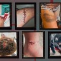 Enquête sur les Violences Policières du 17 Octobre