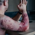 Conditions de travail dangereuses sur les chantiers européens