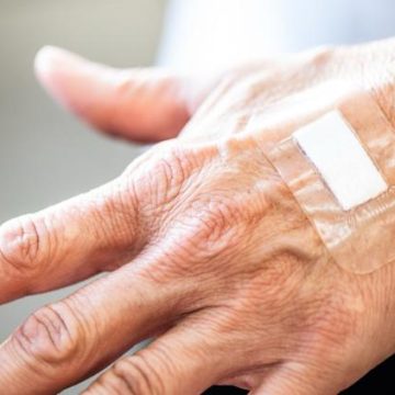 Pourquoi les plaies cicatrisent plus lentement avec l&rsquo;âge